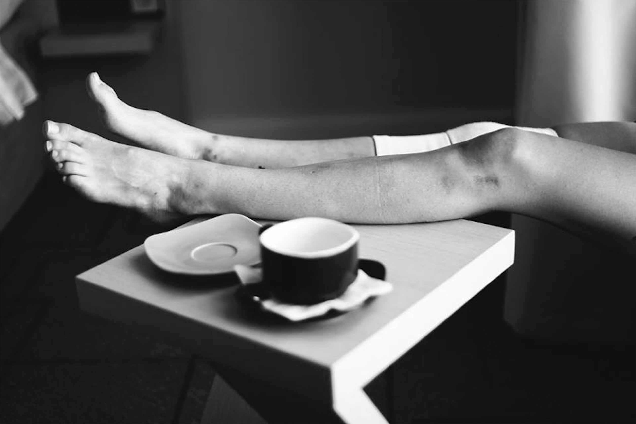 It hurts, 2012. Maria Lima